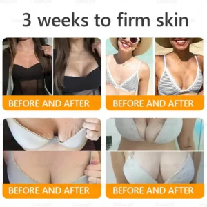 Daasry® Bee Venom Treatment Cream