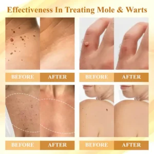 Fivfivgo® Condense Mellifera Venom Skin Repairing Cream