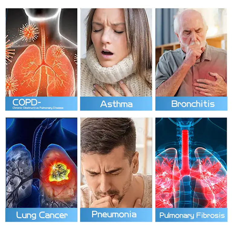 Ourlyard® DoubleNano Advanced Lung Detox Relief Patch