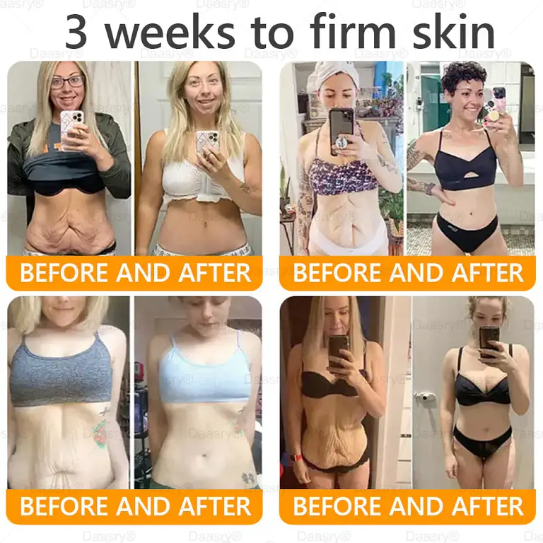 Daasry® Bee Venom Treatment Cream