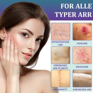 Flysmus® ReGen Hyaluronic Acid Nano-Heal Microneedle Tape