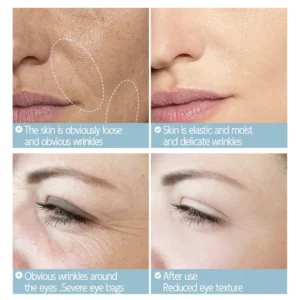 Neslemy™ Anti-Wrinkle Firming Cream