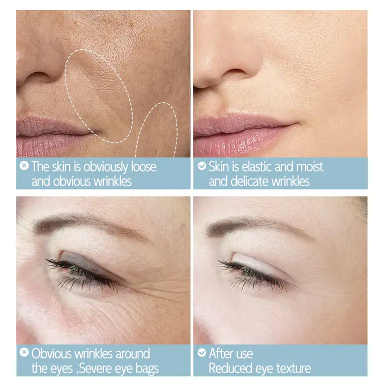 Neslemy™ Anti-Wrinkle Firming Cream