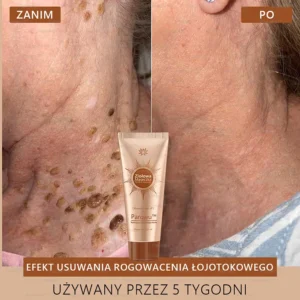 Parowu™ Whitening and Brightening Mask