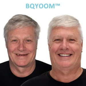 BQYOOMTM Dentures | Invisible Comfort, Natural Grip