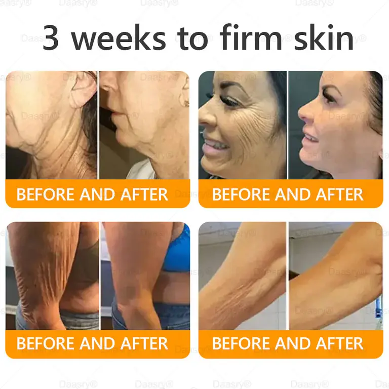 Daasry® Bee Venom Treatment Cream