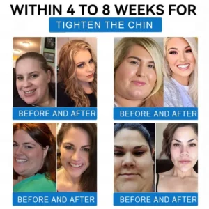 LERCEA® SMGT-GLP-1 Tirzepatide & Collagen Nano Microneedle Weight Loss Patch image LERCEA® SMGT-GLP-1 Tirzepatide & Collagen Nano Microneedle Weight Loss Patch