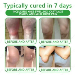 Ourlyard® Advanced Magnesium & Emu Oil Massage Pain Relief Gel