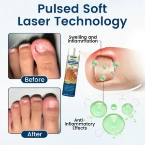 Ourlyard® NailGuard Fungal Repair Herbal Spray