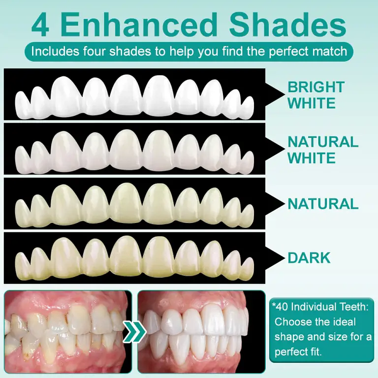 Ourlyard® Instant Stick on Dental Veneers image Ourlyard® Instant Stick on Dental Veneers