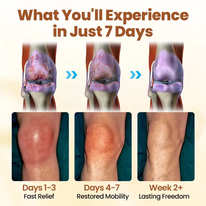 Caselast® Premium Curcumin Pain Relief Gel image Caselast® Premium Curcumin Pain Relief Gel