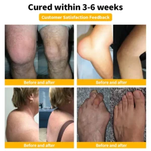 LOVILDS™ Bee Venom Joint Repair Cream image LOVILDS™ Bee Venom Joint Repair Cream