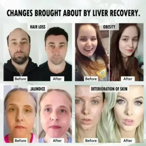 LiverPlus® FGF21 Liver Support Weight Loss Oral Solution