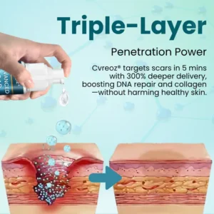 Cvreoz® Advanced Scar Gel image Cvreoz® Advanced Scar Gel