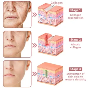 Awzlove™ Coenzyme Q10 Collagen Jelly Skin Cream