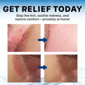 Croaie® Scrotum Itchy Treatment Cream