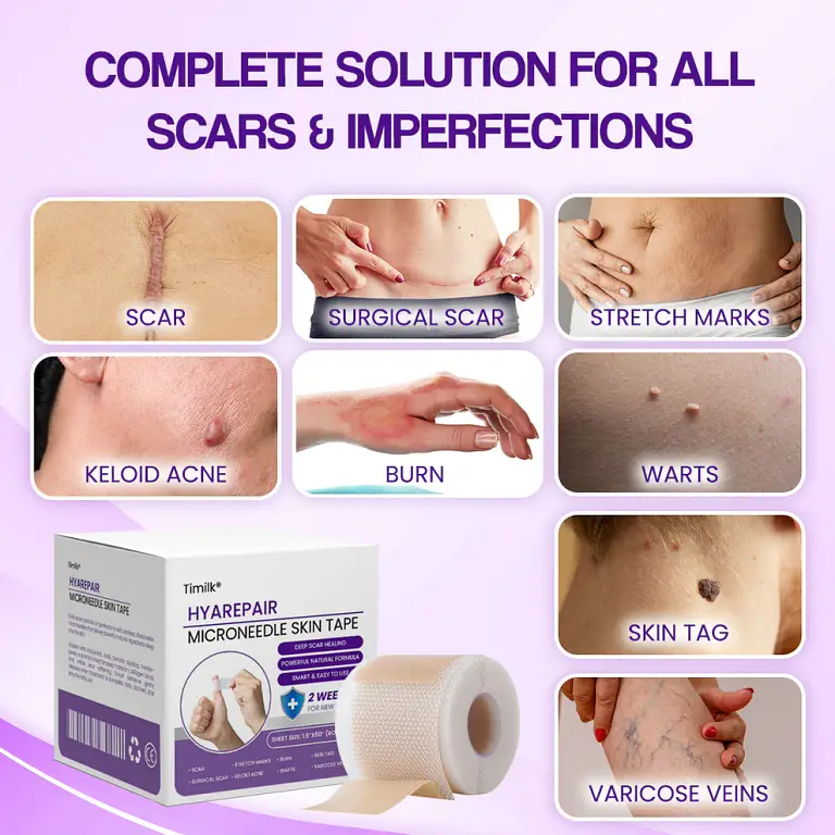 Timilk® HyaRepair Microneedle Skin Tape