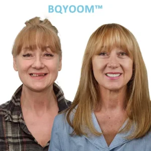 BQYOOMTM Dentures | Invisible Comfort, Natural Grip