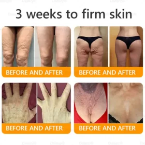 Daasry® Bee Venom Treatment Cream