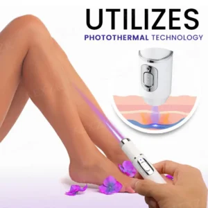 Bikenda® Varicose Vein Photothermal Laser Treatment