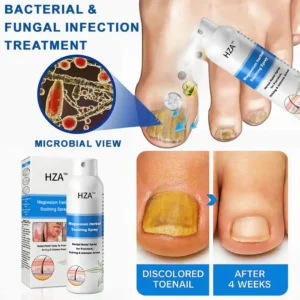 HZA™ Magnesium Herbal Psoriasis Spray