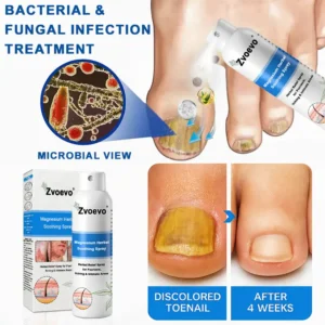 Zvoevo®Magnesium Herbal Psoriasis Spray image Zvoevo®Magnesium Herbal Psoriasis Spray
