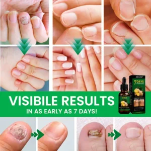 AEXZR® Fungal Nail Treatment