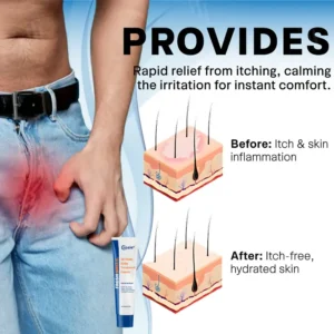 Croaie® Scrotum Itchy Treatment Cream