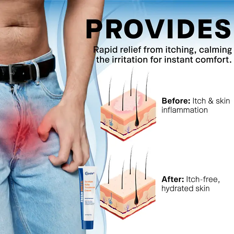Croaie® Scrotum Itchy Treatment Cream