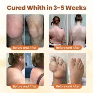 Biancat® Premium Curcumin Pain Relief Gel image Biancat® Premium Curcumin Pain Relief Gel