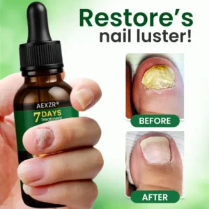 AEXZR® Fungal Nail Treatment