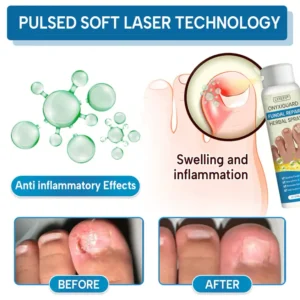 Lyyeto® OnyxiGuard Fungal Repair Herbal Spray ACE image Lyyeto® OnyxiGuard Fungal Repair Herbal Spray ACE