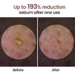 Biancat® Peel Shot Glow Black Rice Ampoule image Biancat® Peel Shot Glow Black Rice Ampoule