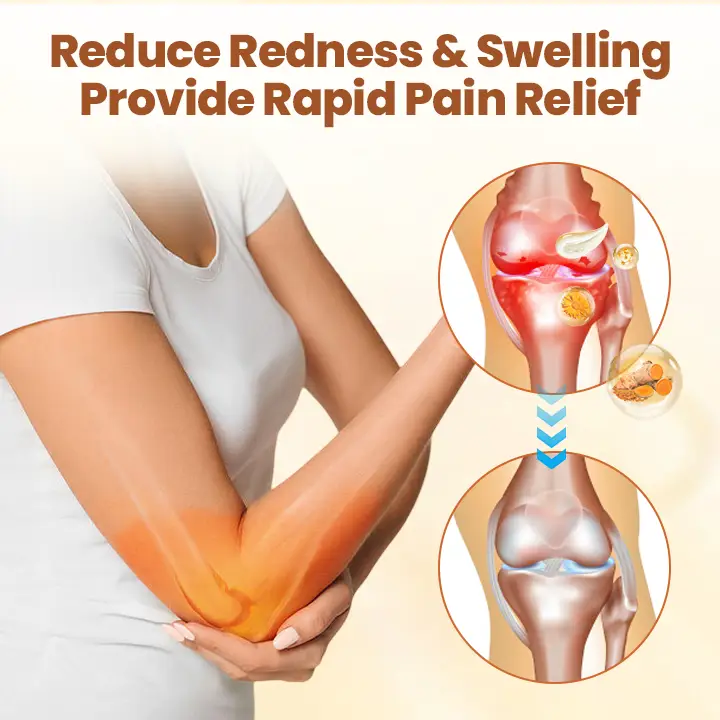 Caselast® Premium Curcumin Pain Relief Gel image Caselast® Premium Curcumin Pain Relief Gel