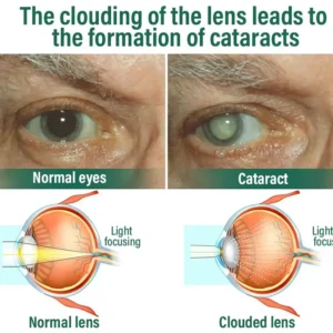 NESLEMY™ Nano Vision Repair Eye Serum