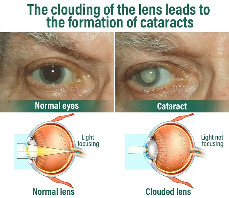 NESLEMY™ Nano Vision Repair Eye Serum