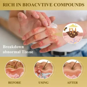 Cvreoz® Condense Mellifera Venom Skin Repairing Cream image Cvreoz® Condense Mellifera Venom Skin Repairing Cream