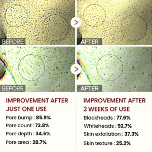 Biancat® Peel Shot Glow Black Rice Ampoule image Biancat® Peel Shot Glow Black Rice Ampoule