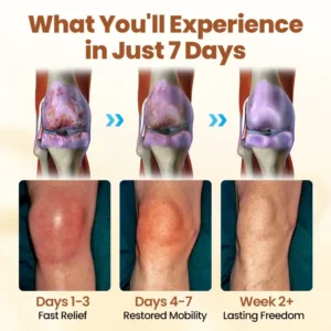 Biancat® Premium Curcumin Pain Relief Gel image Biancat® Premium Curcumin Pain Relief Gel