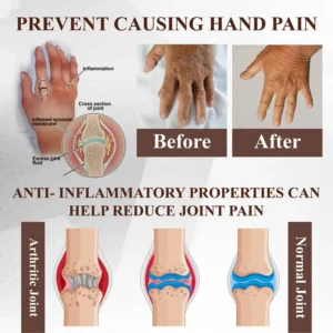 ATTDX® Emu Oil Turmeric UricRelief Therapy Gel