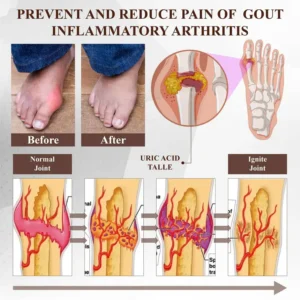 ATTDX® Emu Oil Turmeric UricRelief Therapy Gel