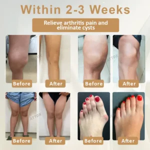 ATTDX® Emu Oil Turmeric UricRelief Therapy Gel