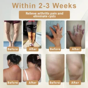 ATTDX® Emu Oil Turmeric UricRelief Therapy Gel