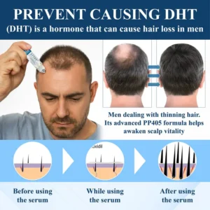 ATTDX® Hair Reawaken PP405 Roll-On Serum