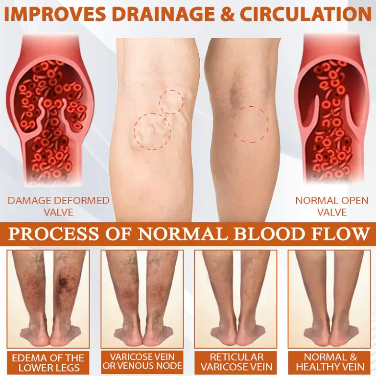 ATTDX® ManukaRelief Edema Therapy Cream