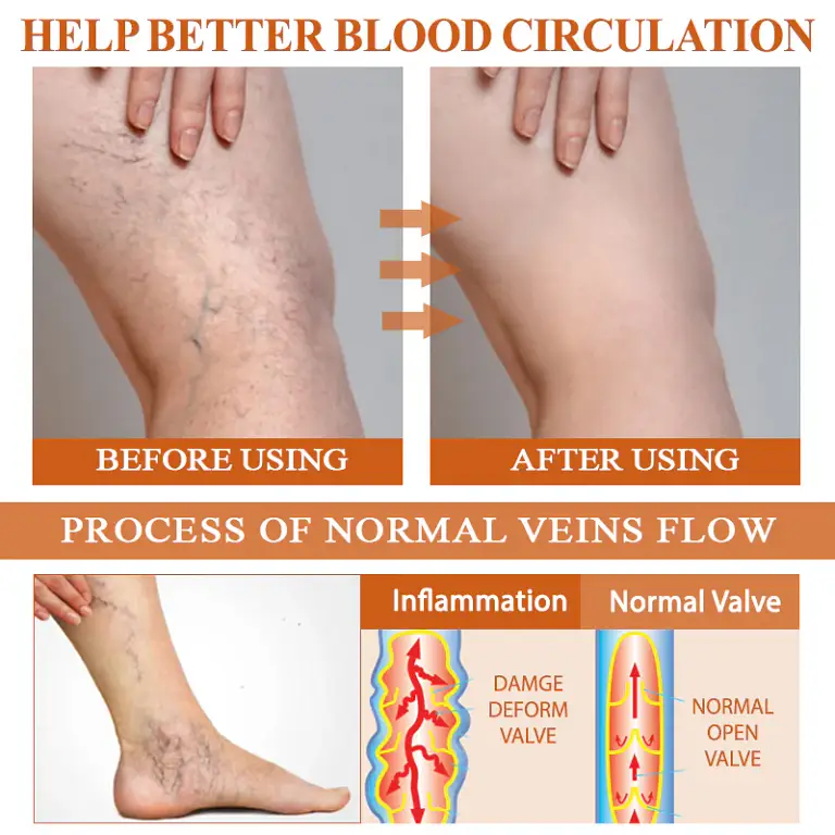 ATTDX® ManukaRelief Edema Therapy Cream