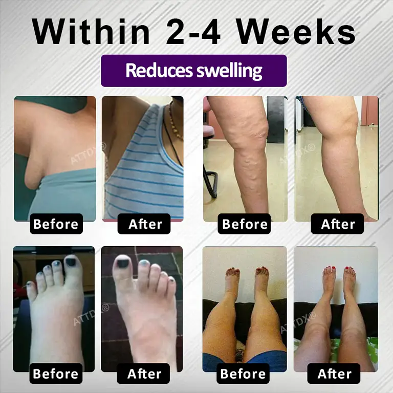 ATTDX® NightDrain Leg Therapy Edema Cream image ATTDX® NightDrain Leg Therapy Edema Cream