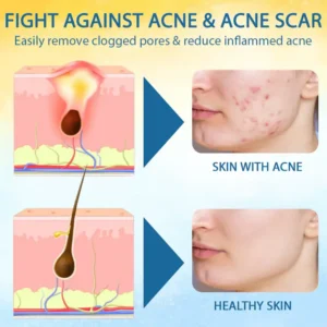 Croaie® PsoriasisCare Mellifera Venom Skin Healing Spray image Croaie® PsoriasisCare Mellifera Venom Skin Healing Spray