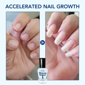Fivfivgo® OnyxoGuard Nail Growth and Repair Serum image Fivfivgo® OnyxoGuard Nail Growth and Repair Serum