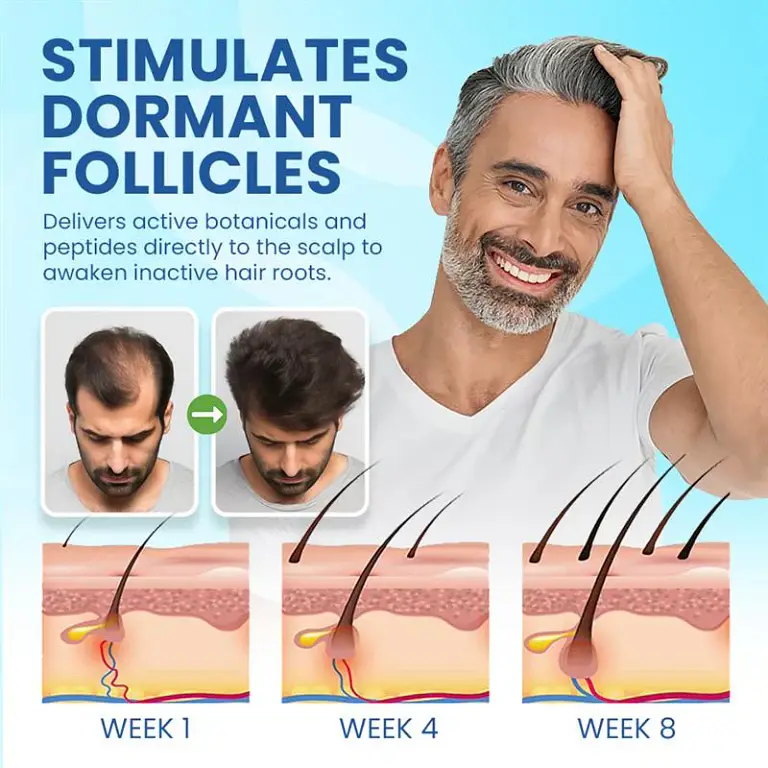 NEGUSY™ Hair Regrowth Stick